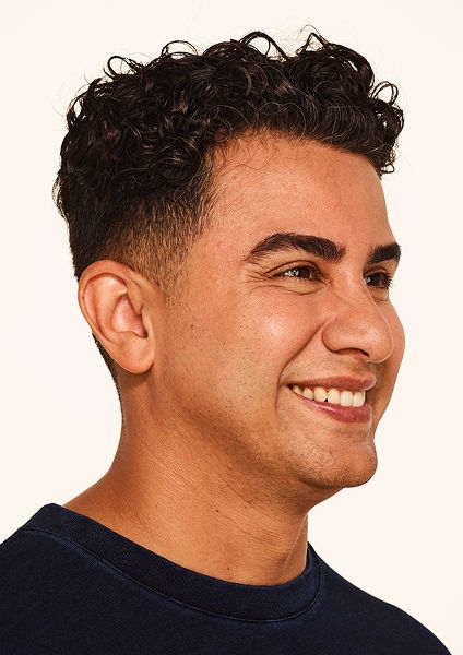 Botox forehead lines, frown lines, crow's feet lines before - Jeffrey