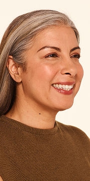 Botox forehead lines, frown lines, crow's feet lines after - Delfina