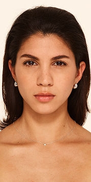 Botox forehead lines, frown lines, crow's feet lines after - Nicole